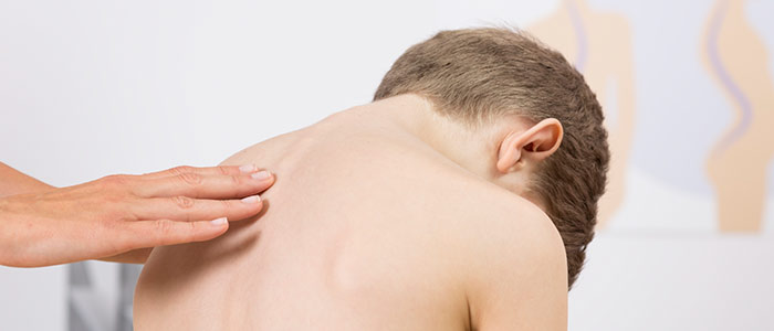 Chiropractic Care in San Antonio For Scoliosis Relief